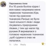 Тернополяни насміхаються над дуже оригінальним рецептом лікування кору