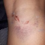 Щоб знати, чи робити щеплення від сказу, тернополянці потрібно спіймати бездомного собаку