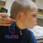 В Івано-Франківську сім’я хлопчика, якого ледь не викинули з четвертого поверху, просить про допомогу