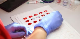 Де можна здати кров у серпні: графік виїзних донацій на Тернопільщині